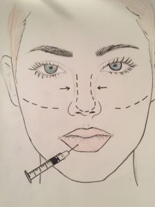 High schoolers in New York often turn to plastic surgery to feel more confident. Artwork by Sophia M. '18